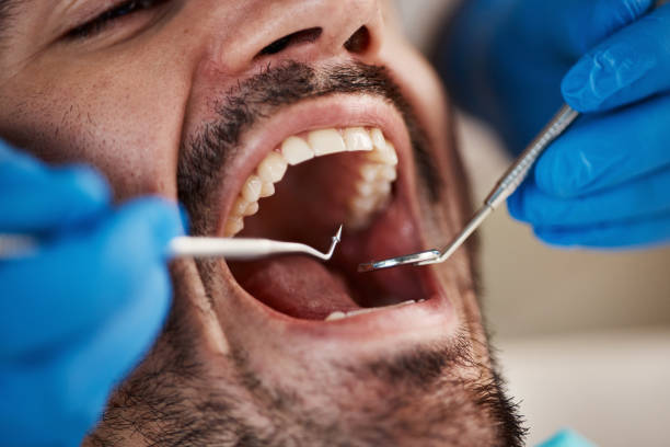 Best Urgent Care for Lost Fillings or Crowns in Landmk, AR